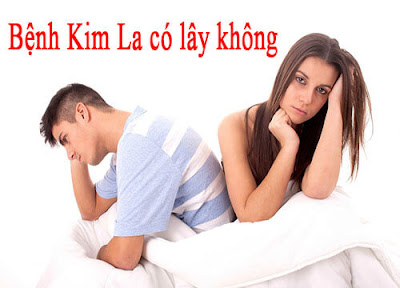 Bệnh kim la có lây không?