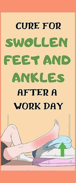 Cure For Swollen Feet And Ankles After A Work Day