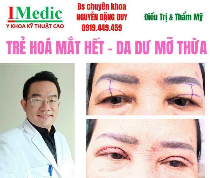 Cắt da dư mỡ thừa mi mắt Cà mau Điều trị sụp mí xệ mí khó nhìn khó đọc chữ Cà mau Mỹ viện Nano Phòng khám chuyên khoa Kỹ thuật cao IMedic Y Khoa Kỹ Thuật Cao Phẫu thuật thẩm mỹ gương mặt Cà mau Sài gòn Bs chuyên khoa NGUYỄN ĐẶNG DUY 091 944 94 59