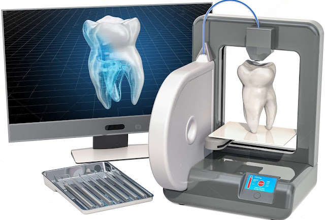 Bioprinting 3D in odontoiatria: una nuova era di impianti dentali e protesi