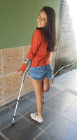 Beautiful girls amputee with crutches