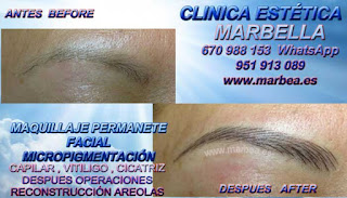 microblading M&#225;laga Clínica Estética Maquillaje Permanente Facial,  Micropigmentación Capilar y microblading cejas en M&#225;laga y Marbella: Te proponemos la mayor calidad de servicios con los mejores especialistas en micropigmentación capilar y microblading cejas