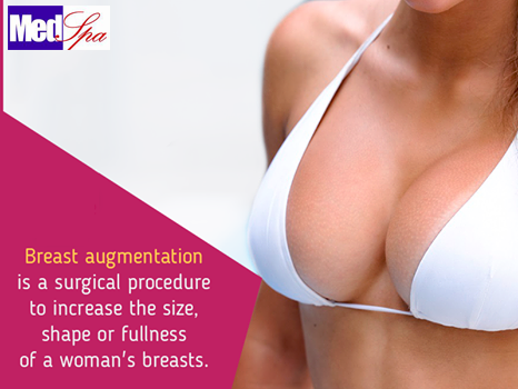 What is a breast implant?