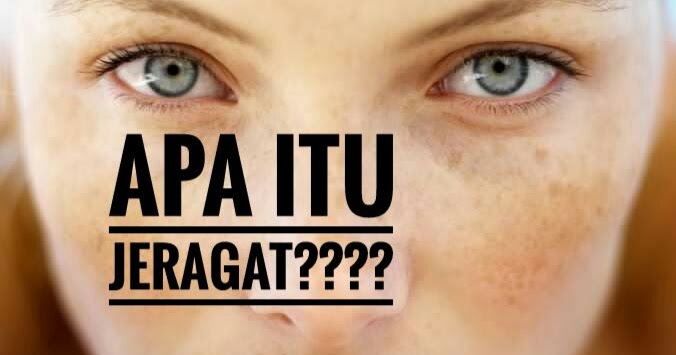 Cara hilangkan JERAGAT dengan cepat