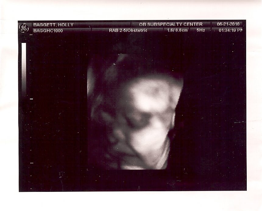 3d ultrasound scan. 3D Ultrasound