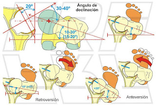 Ángulo de declinación femoral.