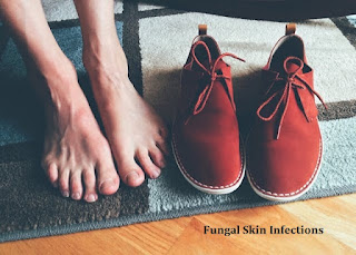 Fungal Skin Infections How to Recognize Them, Treatments, and Preventions
