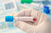 نئے کورونا وائرس کی وبا کا باعث بننے والے جاندار کی پہچان ہوگئی؟
