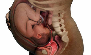 penekanan bayi pada ibu hamil dapat mengakibatkan nyeri punggung dan menjepit saraf pinggul