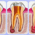 Điều trị răng chết tủy