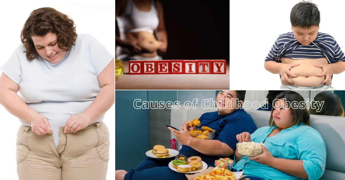Causes of Childhood Obesity