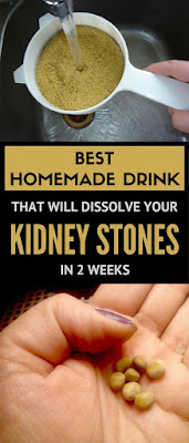 Best Homemade Drink that will Dissolve your Kidney Stones in 2 Weeks