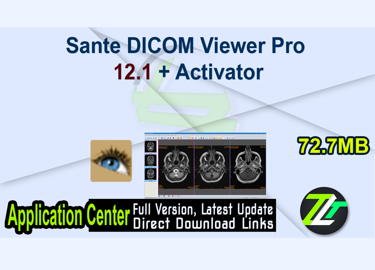 Sante DICOM Viewer Pro 12.1 + Activator
