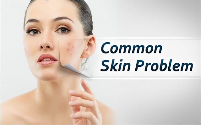 What are the common skin problems? Your Health Blog