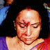 Hema Malini Car accident;Child killed and actress with minor injuries 