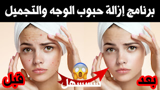 تحميل برنامج إزالة حبوب الوجه وتنعيم البشرة مع الشرح | you cam makeup