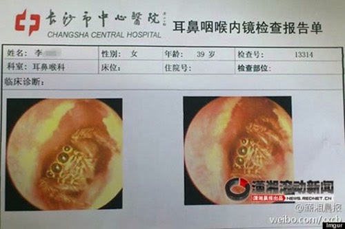Những con vật khủng khiếp từng chui lỗ tai người - 2