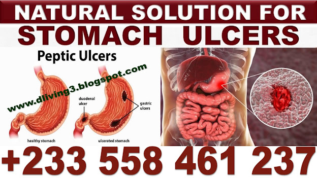 NATURAL SOLUTIONS FOR STOMACH ULCER