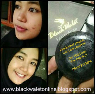 sabun muka blackwalet