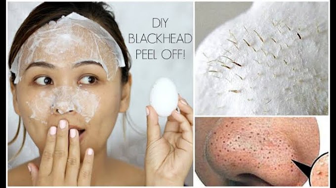 Use it twice a year and you will get rid of black and white heads without any trouble