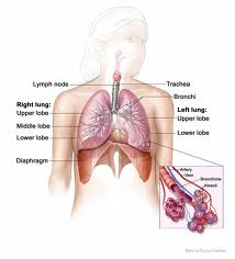 Mesothelioma - Compensation Claims