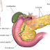 Cancer De Pancreas Sintomas