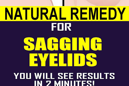Natural Remedy For Sagging Eyelids You Will See Results In 2 Minutes!!!
