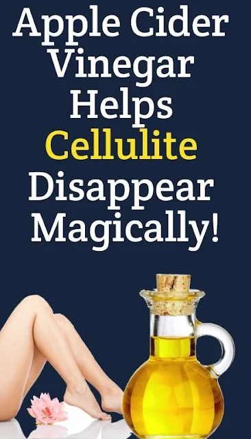How To Use Apple Cider Vinegar To Eliminate Cellulite