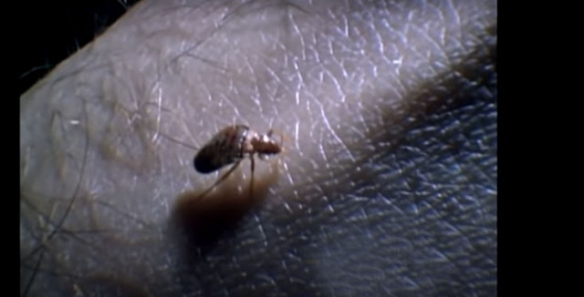 Bed Bug on Human Skin