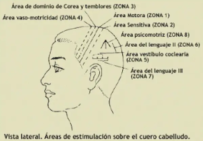área de dominio de corea y temblores - mcdevservices spa - craneopuntura