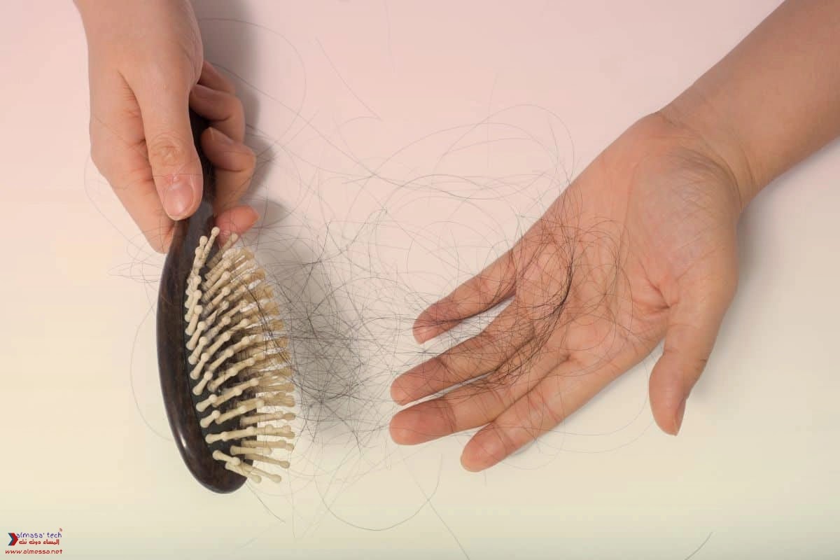 كيفية استخدام الثوم لمنع تساقط الشعر