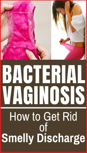 How To Get Rid Of Smelly Discharge | Bacterial Vaginosis