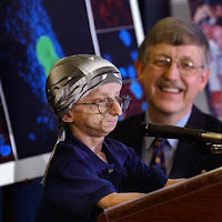 Progeria-Disease