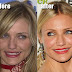 Cameron Diaz : Chirurgie esthétique