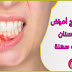 وصفة لعلاج إلتهاب للثة الاسنان بمكونات طبيعية مع - Kitchen Nour