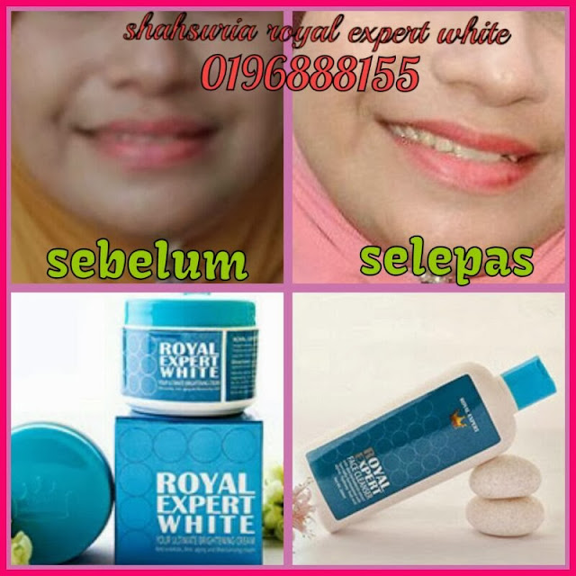 Promosi Royal Expert White Malaysia Original Royal Expert White Testimoni 12