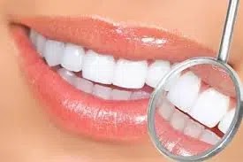 Teeth whitening , white teeth