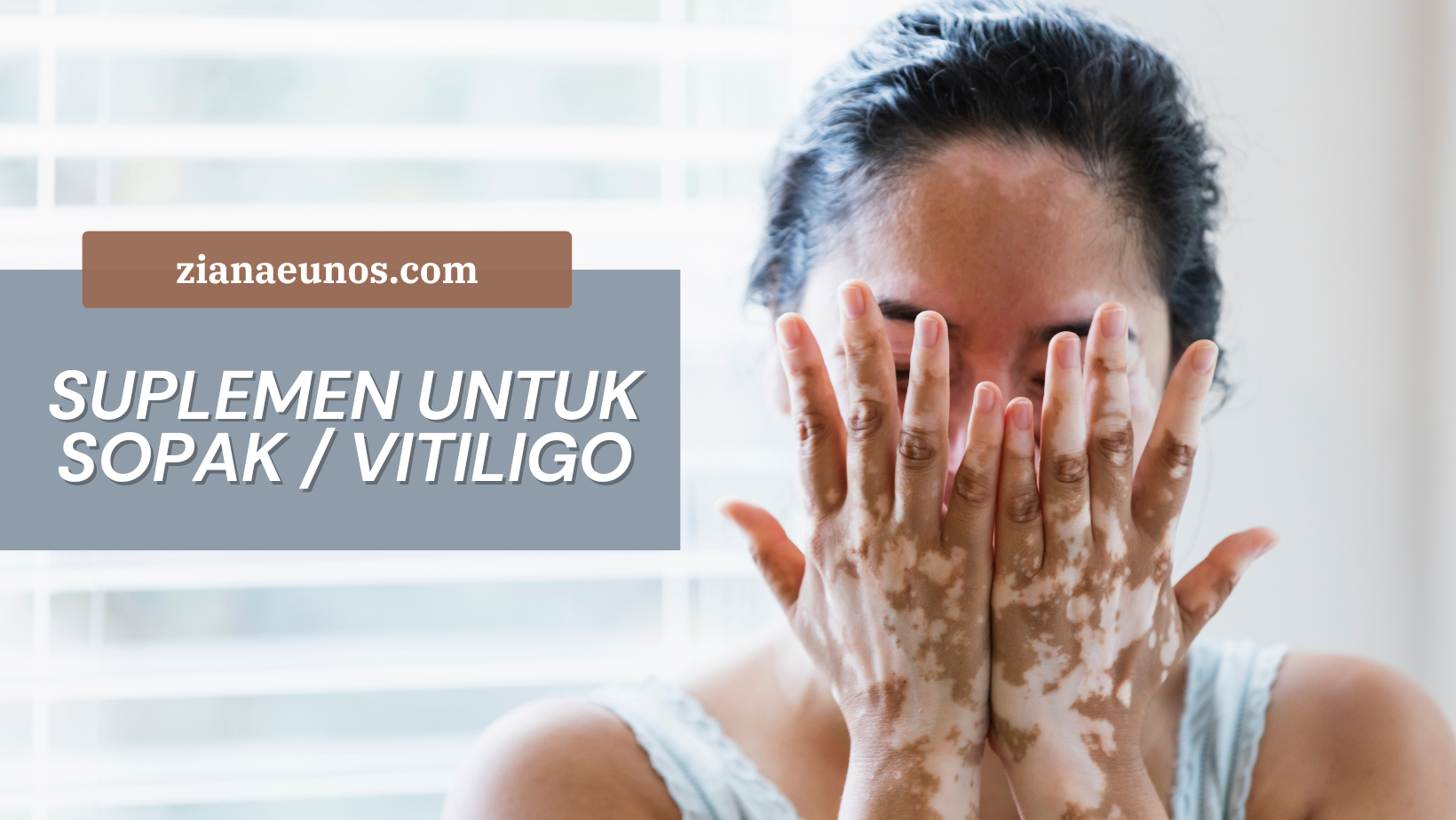 shaklee untuk sopak vitiligo