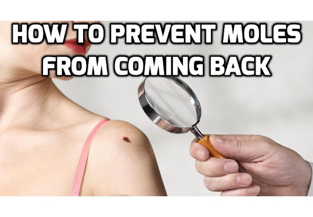 There are a few things you can do to try to prevent skin moles from coming back after removal. Read on here to find out more.