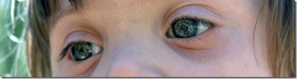 Landons Eyes