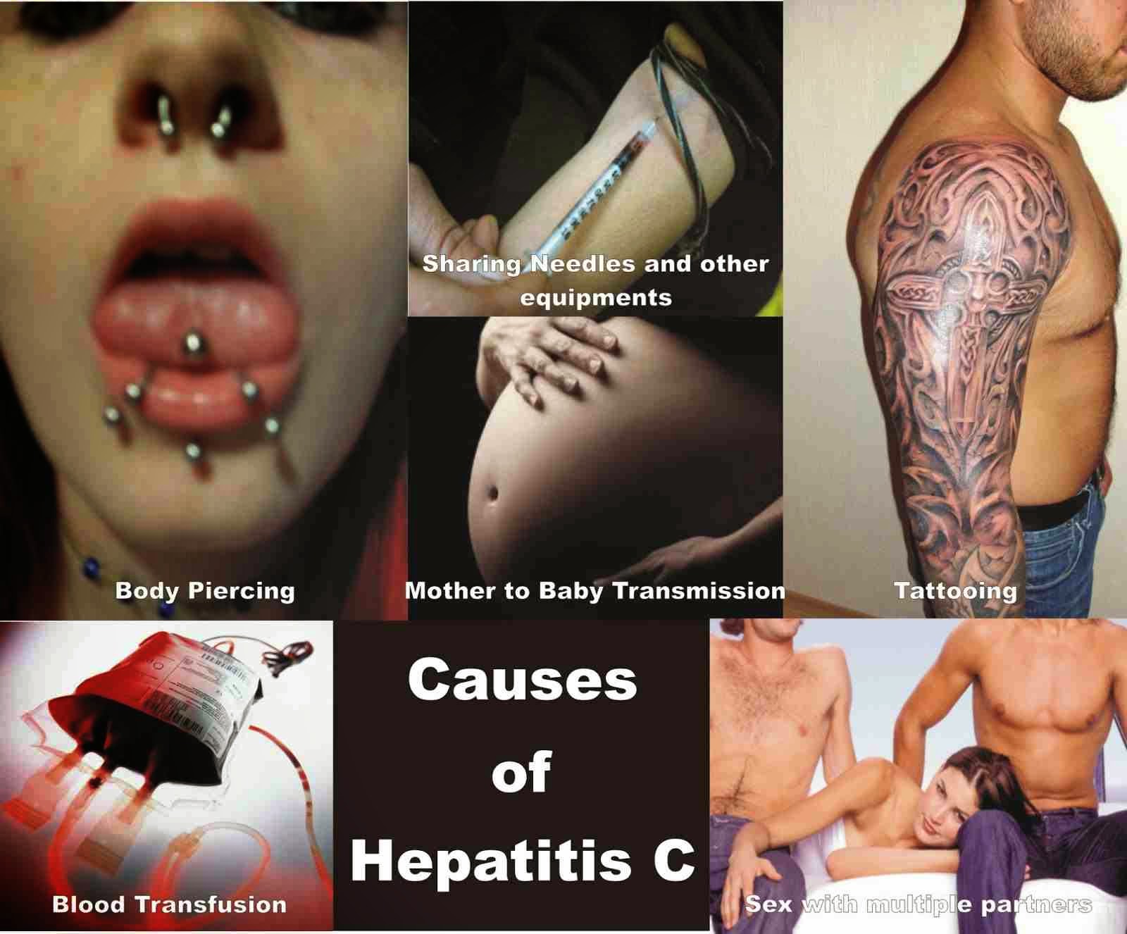 Hepatitis C