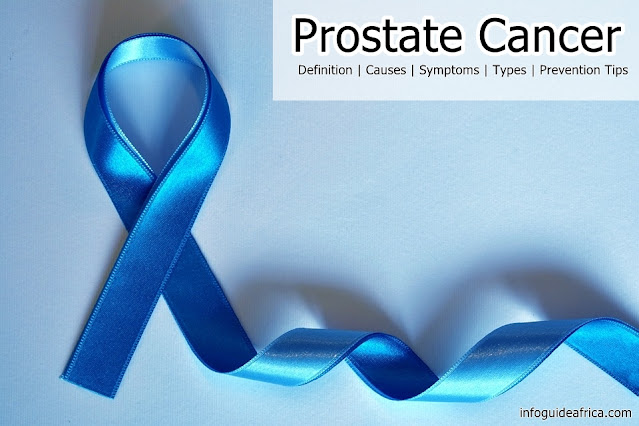 Prostate Cancer