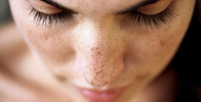 how to get rid of spots
