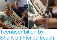 http://sciencythoughts.blogspot.com/2018/05/teenager-bitten-by-shark-off-florida.html