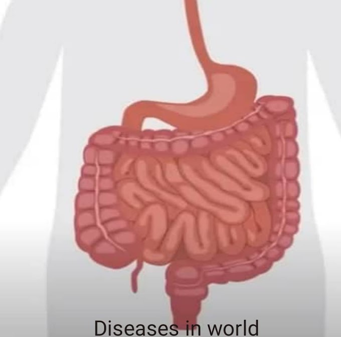 How New Technologies are Revolutionizing Colon Cancer Diagnosis, without a biopsy?