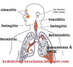 infeksi-saluran-pernafasan-atas-bawah