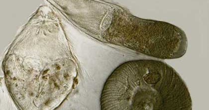 6 Macam Filum Protozoa (Protista Mirip Hewan), Gambar 