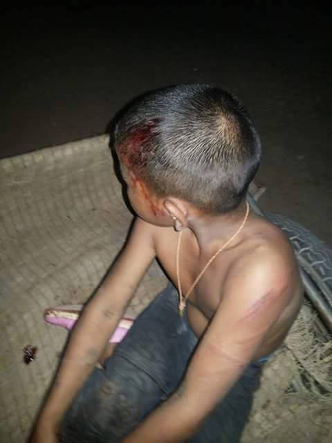 This boy was beaten up by his mother after he skipped school!