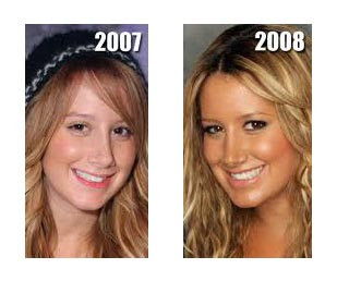 Ashley Tisdale Plastic Surgery