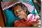 AIDS death